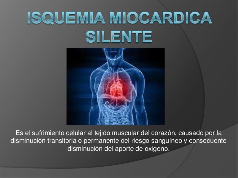 Isquemia del corazon definicion